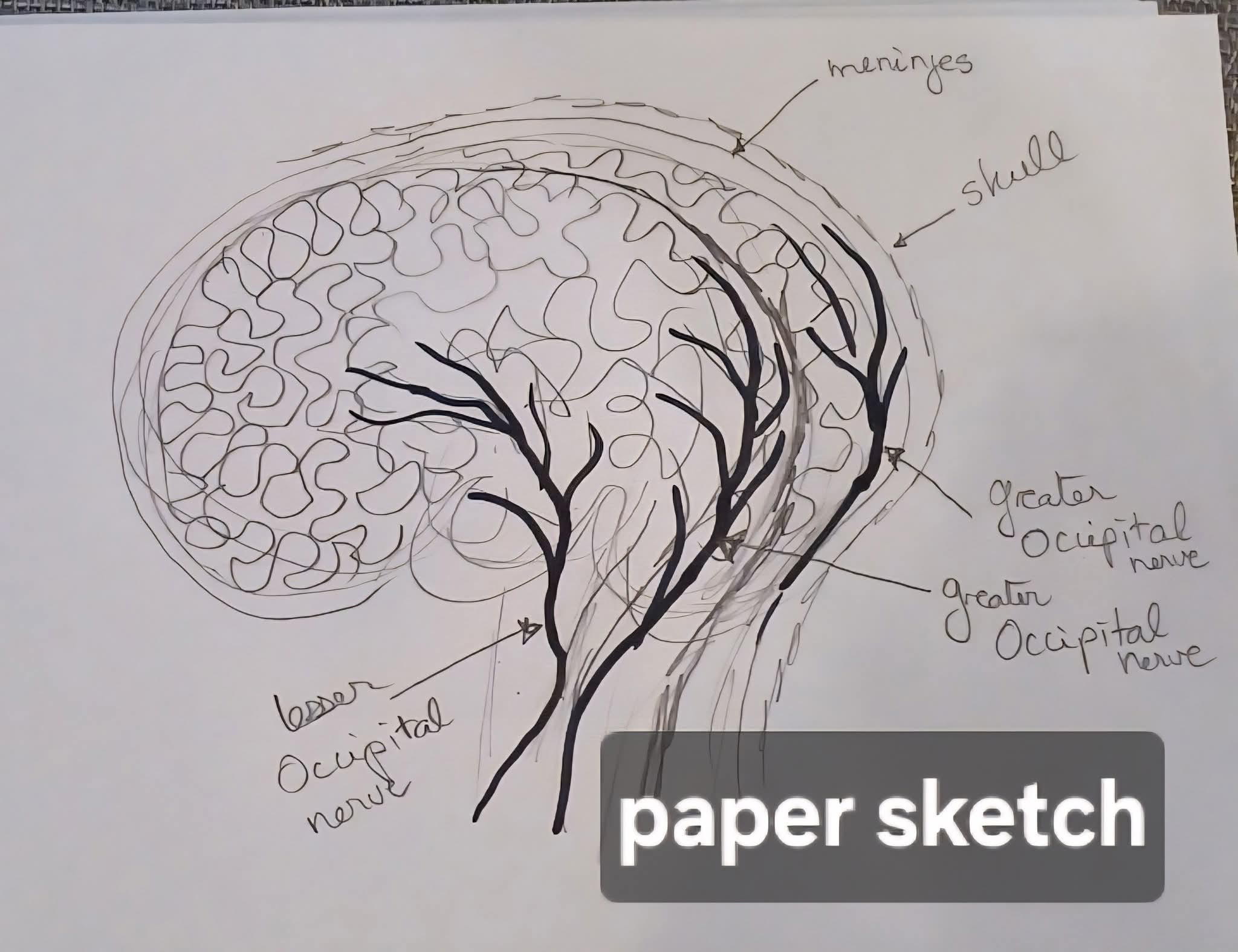 Early brain sketch